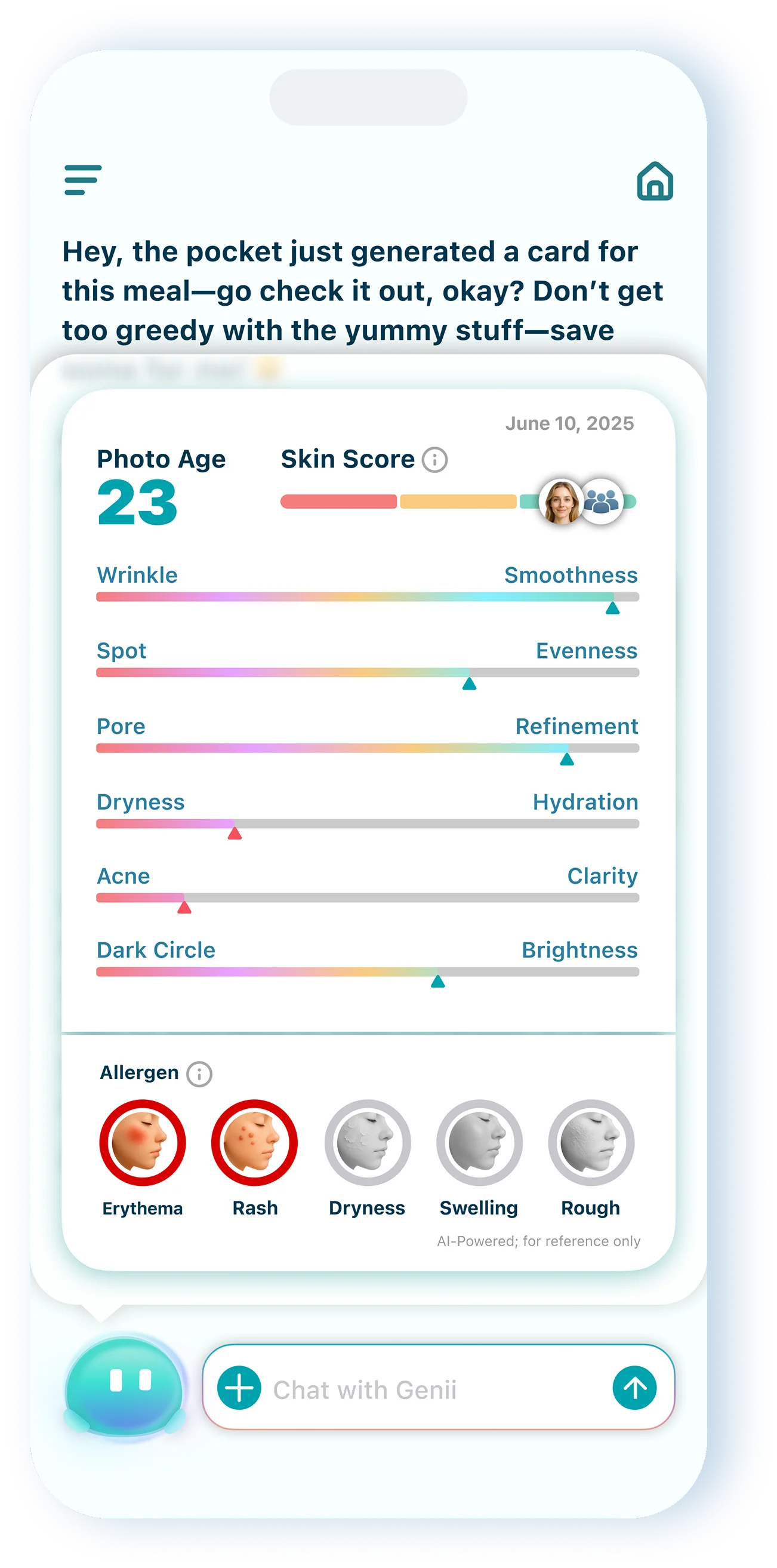Showcase UI 5